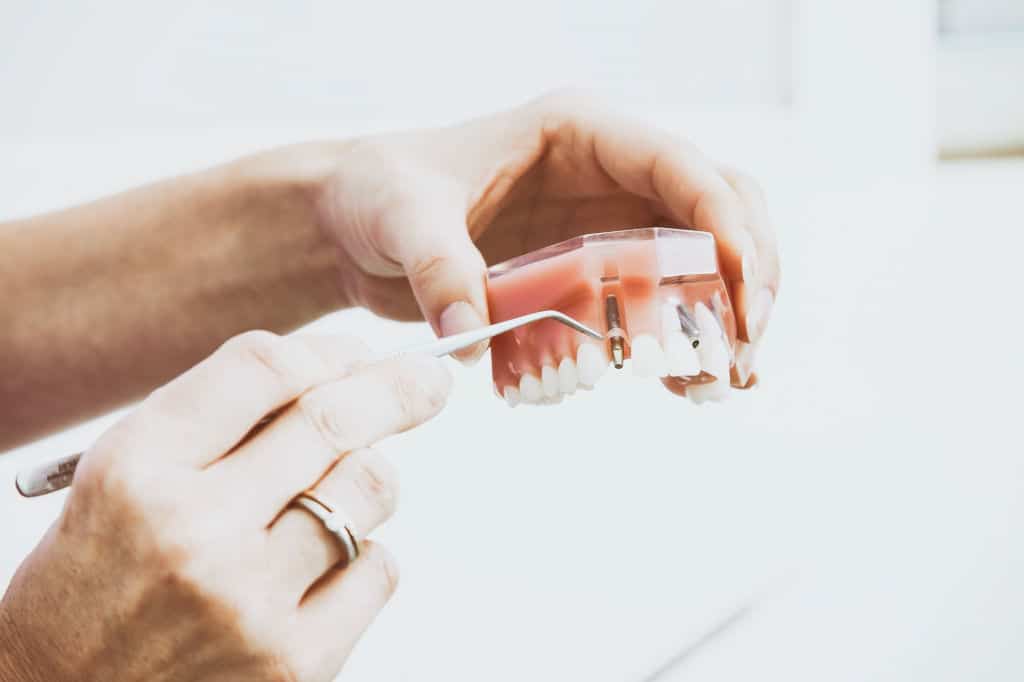 doctor holding dental implant model denture
